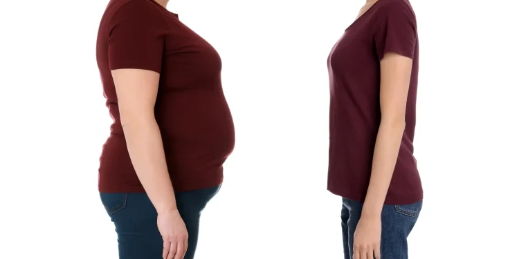 Typ-2-Diabetes: Gewichtsverlust schützt nicht alle gleich